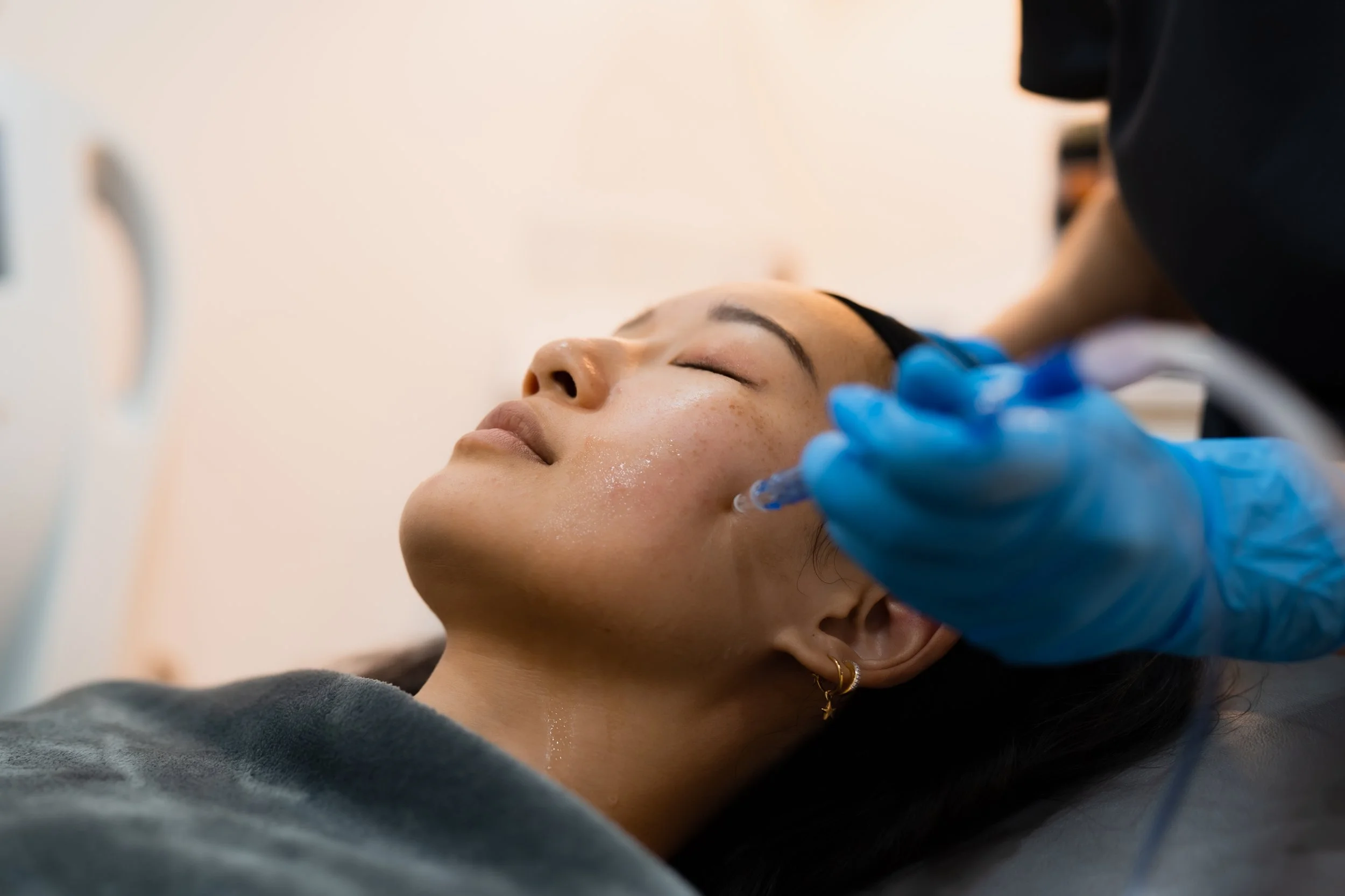 JetPeel™ Treatment Singapore| Medispa & Medical Aesthetics Clinic in Singapore | Acclaro Clinic ...